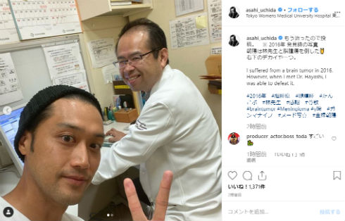 内田朝陽 病気 脳腫瘍 いつ 髄膜腫