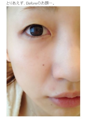 あいのり桃 整形 アイプチ ビフォー・アフター 無断使用