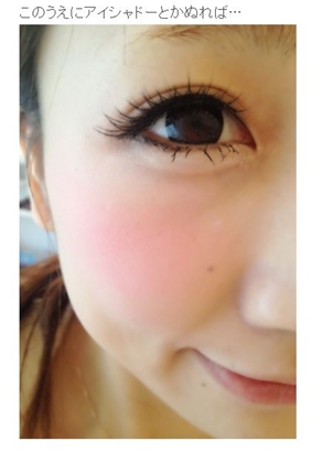 あいのり桃 整形 アイプチ ビフォー・アフター 無断使用