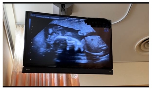 藤本美貴 妊娠 出産 性別 赤ちゃん 子ども