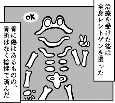 バイクで事故ったレポ漫画