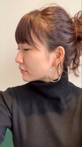 桃 あいのり 鼻 プチスレッド・ノーズアップ 鼻先 美容整形 プチ整形 二重 埋没 ブログ