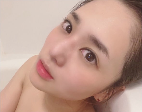 蒼井そら 帝王切開 傷口 ケロイド 形成外科