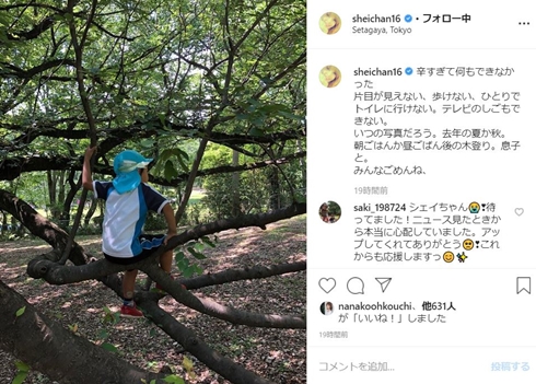 sheila シェイラ くも膜下出血 病気 モデル