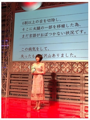 堀ちえみ 舌がん 口腔がん 徹子の部屋 活動再開 復帰 手術