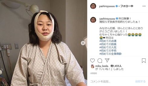 やしろ優 親知らず 抜歯 入院 手術