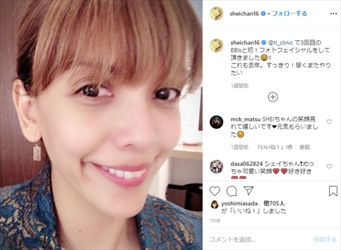 SHEILA くも膜下出血 緊急手術 後遺症 リハビリ インスタ