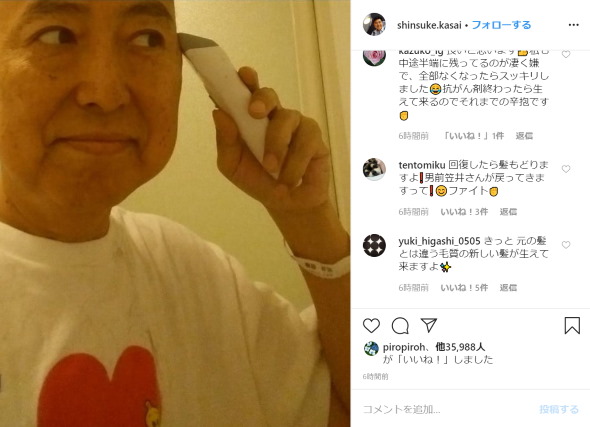 笠井信輔 悪性リンパ腫 抗がん剤治療 副作用 脱毛