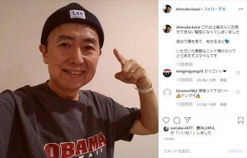 笠井信輔 悪性リンパ腫 抗がん剤治療 副作用 脱毛