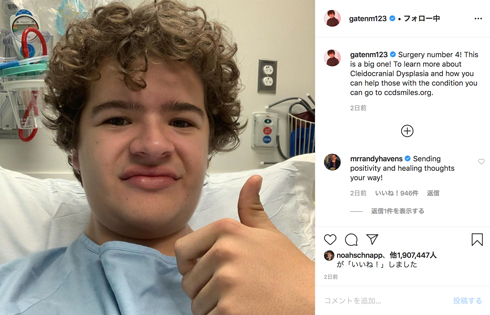 ストレンジャー・シングス ダスティン 鎖骨頭蓋異骨症 手術
