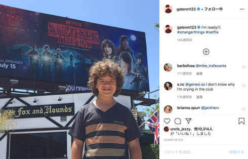 ストレンジャー・シングス ダスティン 鎖骨頭蓋異骨症 手術