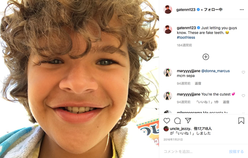 ストレンジャー・シングス ダスティン 鎖骨頭蓋異骨症 手術