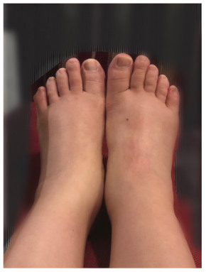 キンタロー。 妊娠 出産 娘 ものまね ブログ