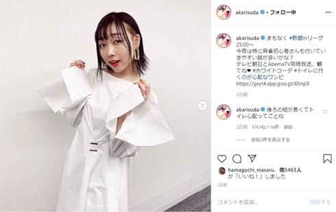須田亜香里 SKE48 金属アレルギー スッキリ アクセサリー