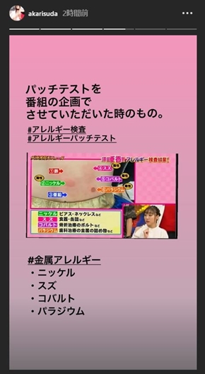 須田亜香里 SKE48 金属アレルギー スッキリ アクセサリー