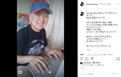 笠井信輔 悪性 リンパ腫 抗がん剤 頭髪 ウィッグ インスタ
