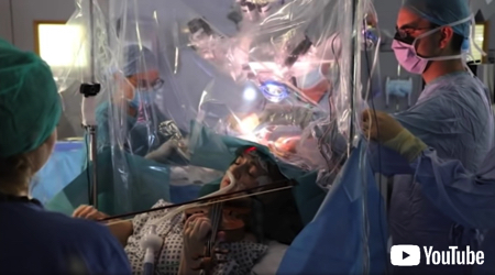 脳の手術中にバイオリンを弾く患者