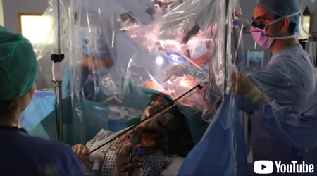 脳の手術中にバイオリンを弾く患者