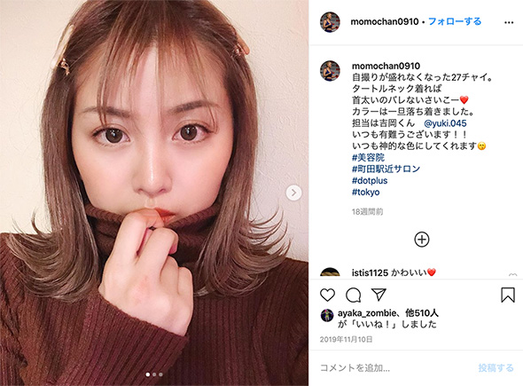 山崎桃子 格闘家 暴行被害 網膜裂孔