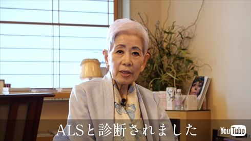 佐伯チズ 筋萎縮性側索硬化症 ALS 難病 美容家
