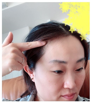 キンタロー 薄毛 出産 ちびキンちゃん 産後