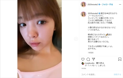 藤田ニコル 火傷 コテ インスタ 火傷痕 すっぴん