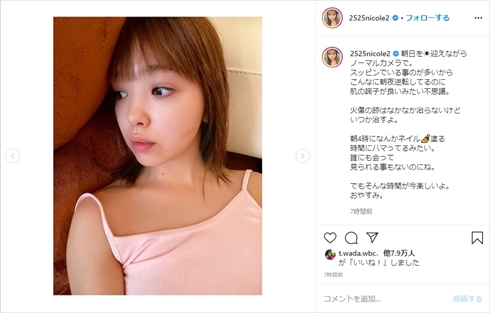藤田ニコル 火傷 コテ インスタ 火傷痕 すっぴん