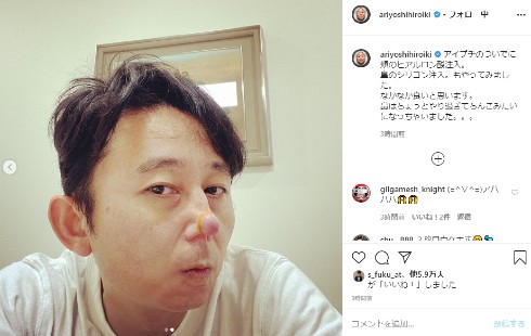 有吉弘行 インスタ 顔 アイプチ