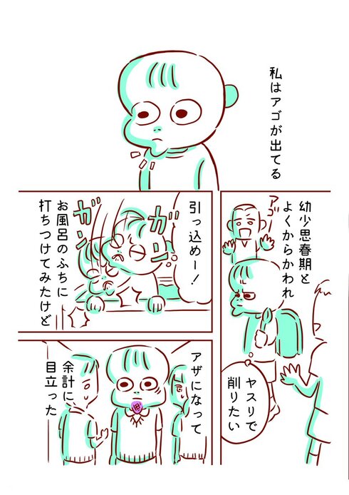 アゴと私と彼01