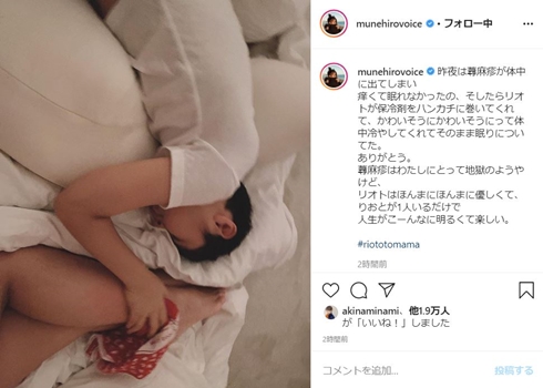 鈴木紗理奈 息子 蕁麻疹 子供