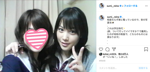 鷲見玲奈 整形 疑惑 否定