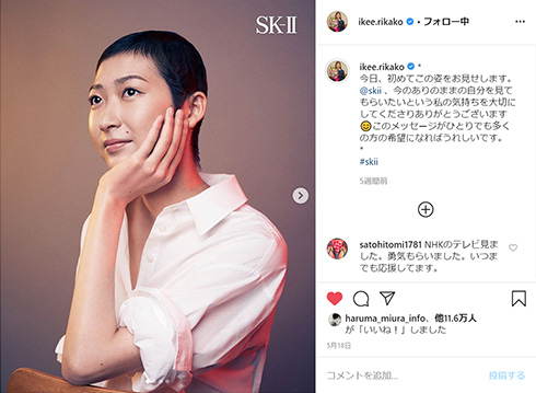 池江璃花子 競泳 SK-II ウィッグ 白血病 反響 手紙