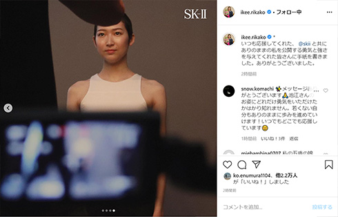 池江璃花子 競泳 SK-II ウィッグ 白血病 反響 手紙