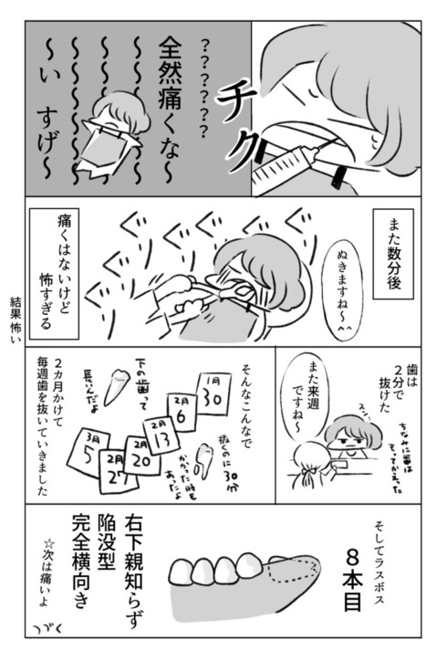 歯の矯正で人生が変わるエッセイ04