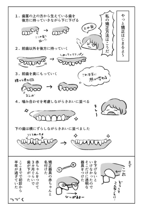 歯の矯正で人生が変わるエッセイ08