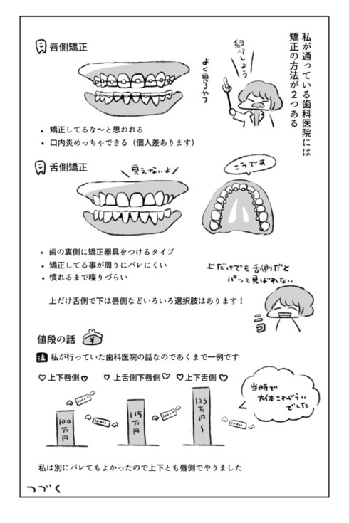 歯の矯正で人生が変わるエッセイ09