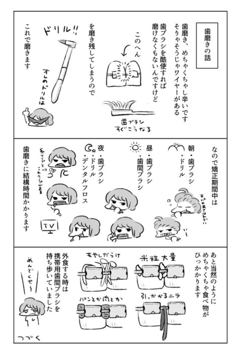 歯の矯正で人生が変わるエッセイ13