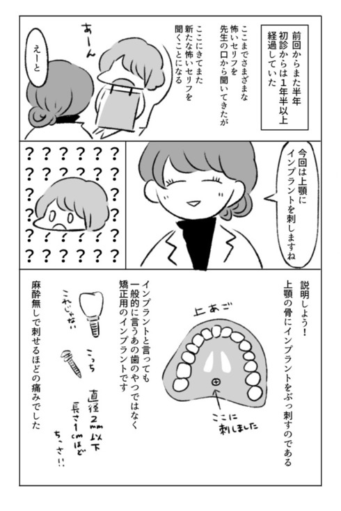 歯の矯正で人生が変わるエッセイ16