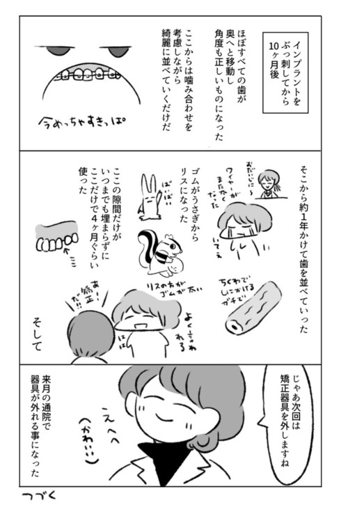 歯の矯正で人生が変わるエッセイ18