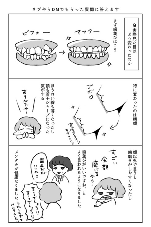 歯の矯正で人生が変わるエッセイ24