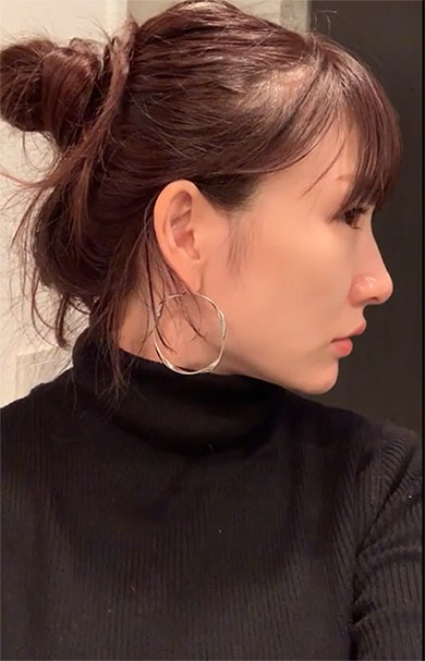 桃 あいのり 整形 鼻