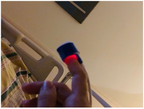 LiLiCo 骨折 小田井涼平