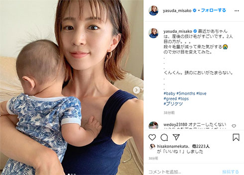 安田美沙子 産後 髪