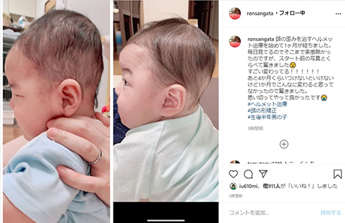 エヴァンゲリオン アスカ・ラングレー 桜 稲垣早希