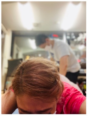 LiLiCo 手術 骨折 ブログ リハビリ