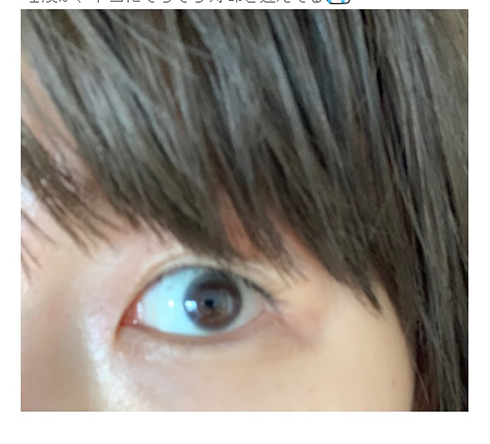 あいのり 桃 プチ整形 二重まぶた
