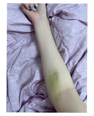 モーニング娘。 田中れいな 救急車 胃