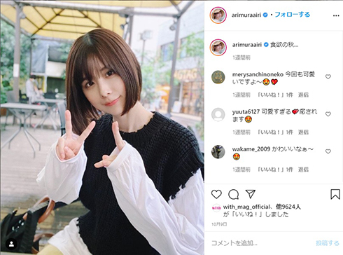 有村藍里 美容整形手術