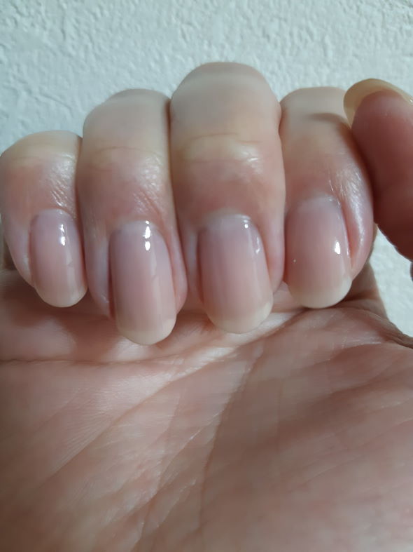 爪 ネイル ケア ビフォーアフター