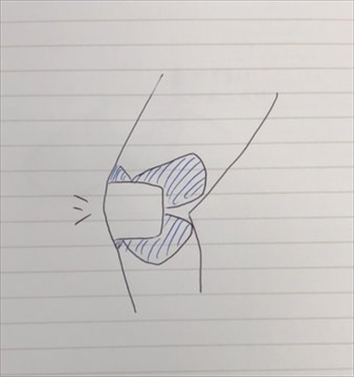 絆創膏	ばんそうこう 貼り方
